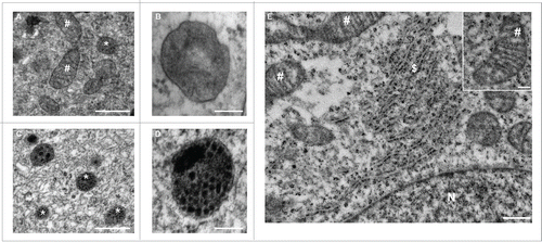 Figure 2. Ultrastructural examination of cells incubated in the absence or presence of PLGA-aNP. Ultrastructural examination of M17 cells, untreated ((A) and B) or incubated with PLGA-aNP for 24 h ((C) to E). High magnification picture of a lysosomal-related vesicle containing PLGA-aNP (D). Other organelles did not contain PLGA-aNP after 24 h incubation (E). Inset is a high magnification picture of mitochondria. #, mitochondria; *, autophagic vesicles; $, endoplasmic reticulum; N, nucleus. Scale bars: 500 nm (A,C,E); 200 nm (E, inset); 100 nm (B,D).