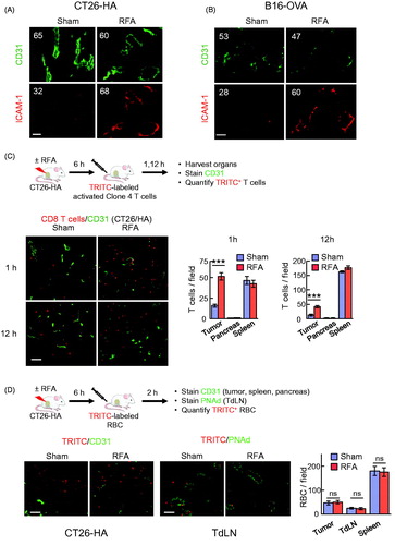 Figure 4. RFA augments ICAM-1 and trafficking of adoptively transferred in vitro-activated CD8+ T cells in tumor vessels. (A, B) Intravascular staining of ICAM-1 in CT26-HA tumor (A) or B16-OVA tumor (B). Tumor-bearing mice were injected iv with ICAM-1 Ab 6 hours after RFA or sham treatment. Twenty minutes after injection, tumors were harvested and cryosections were counterstained with TRITC-conjugated secondary Ab (red) and anti-CD31 Ab (green) to identify vessel position. Numbers indicate MFI determined by quantification of all pixels analyzed within CD31+ vessels in ≥10 fields of non-sequential cryosections for each treatment group. (C) Schematic illustration investigating immunomodulatory effect of RFA in BALB/c mice bearing CT26-HA tumors. Representative photomicrographs and quantification of TRITC-labeled activated Clone 4 splenocytes (red) in the indicated organs (CT26-HA tumor, pancreas, and spleen) counterstained for CD31+ vessels (green) 1 hour or 12 hours after sham procedure or RFA. (D) Schematic of experimental design to investigate leakage of cells after RFA in BALB/c mice bearing CT26-HA tumor. Representative photomicrographs and quantification of TRITC-labeled RBC (red) in CT26-HA tumors or TdLN 2 hours after sham procedure or RFA; tumor tissues counterstained for CD31+ vessels and LN were stained for PNAd+ HEV (green). ***p < 0.001; ns: not significant as determined by unpaired, two-tailed Student’s t-test. Scale bars, 100 μm; data are mean ± SEM of ≥10 fields analyzed from independent mice (n = 3 mice per group) and are representative of 2 experiments.