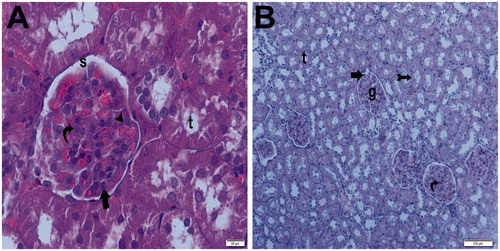 Figure 12. (Sham + aliskiren 100 mg/kg) (A) Light microscopy of a glomerulus demonstrating normal thickening of the glomerular capillary wall. Podocyte (arrow) and mesangial cell (curved arrow). Typical capsular spice (s) and tubular structure (t). H&E stain. (B) Light microscopy of a glomerulus demonstrating normal glomerular structure and typical bowman space (arrow). Typical tubular basement membrane (tailed arrow). H&E stain.
