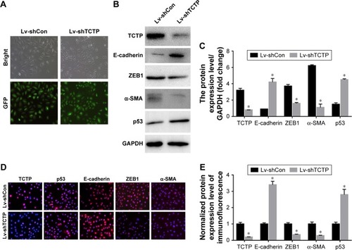 Figure 2 TCTP silencing in A549 cells using lentivirus-based short-hairpin RNA (Lv-shTPT1).Notes: (A) Representative images of GFP expression in A549 cell lines in both Lv-shCon group and Lv-shTCTP group. (B) The expression of TCTP, E-cadherin, α-SMA, ZEB1, and p53 in the parental and TPT1-silenced A549 cell lines was examined by Western blot. (C) Bar graph of the expression levels of the proteins in (B). (D) The expression of TCTP, E-cadherin, α-SMA, ZEB1, and p53 in the parental and TCTP-silenced A549 cell lines was examined by confocal laser microscopy. (E) Bar graph of the expression levels of the proteins in (D). *P<0.01.