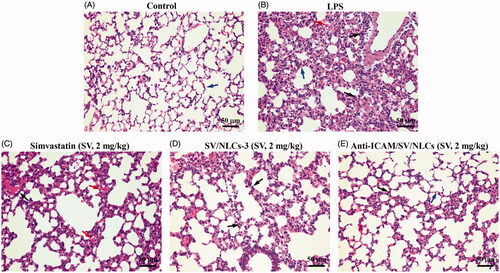 Figure 7. Histopathological examination. Lung section of (A) control mice, (B) LPS-induced model mice, (C) free simvastatin-treated mice, (D) non-targeted SV/NLCs-3-treated mice, (E) anti-ICAM/SV/NLCs-treated mice. The blue arrows indicate alveolar wall. The red arrows depict the alveolar wall hyperemia. The black arrows indicate the neutrophils infiltration (bar = 50 μm).