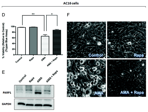 Figure 5D–F. (D and E) AC16 cells were treated with rapamycin or AMA alone or were coincubated with AMA and rapamycin for 48 h. Cell viability was subsequently assessed using trypan blue exclusion assay (D) or cell lysates were collected and immunoblotted for PARP1 (E). (F) AC16 cells were treated with rapamycin or AMA alone or were coincubated with AMA and rapamycin for 36 h. Phase contrast images of cells were subsequently taken. Representative images are shown. Rapa, rapamycin. *p < 0.05; **p < 0.01 vs. control (for A, previous page, and D). Data represent three independent experiments.