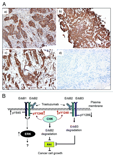 Figure 7. Positive ErbB2-pY1248 staining in ErbB2-positive breast cancer biopsies correlates with the increased trastuzumab response in trastuzumab neoadjuvant settings. (A) Immunohistochemical staining using an anti-phospho-ErbB2-Y1248 antibody on representative cases of core biopsies obtained from breast cancer patients before neoadjuvant trastuzumab treatment. (a and b) Positive with 3+ staining; (c) negative (+, with predominantly cytoplasmic and focal incomplete membrane staining); (d) negative staining. Cases (a and b) had complete pathologic response after trastuzumab treatment. Cases (c and d) had residual disease. (B) Model depicting trastuzumab-mediated interaction between CHK and ErbB2 to regulate ErbB2 phosphorylation at Y1248 and degradation. Overexpression of ErbB2 in trastuzumab-sensitive breast cancer cells leads to heterodimer formation among ErbB family members (ErbB1/ErbB2 and ErbB2/ErbB3). This results in the basal phosphorylation of ErbB2 at Y1248 creating docking sites for downstream effectors such as CHK. When binding to the extracellular domain of ErbB2, trastuzumab stimulates kinase activity of ErbB2, resulting in an increase in ErbB2-pY1248. This in turn promotes recruitment of CHK to ErbB2 via ErbB2-pY1248. Upon binding to ErbB2, CHK further enhances the phosphorylation of ErbB2-Y1248 and induces ErbB2 degradation. Binding of trastuzumab to ErbB2 does not interfere with heterodimer formation between ErbB1 and ErbB2, but rather induces ErbB1-Y845 phosphorylation. This may lead to the induction of ERK1/2 phosphorylation. However, the role of ERK1/2 phosphorylation induced by trastuzumab in trastuzumab-mediated growth inhibition remains elusive. Binding of trastuzumab to ErbB2 in ErbB2/ErbB3 heterodimers leads to the inhibition of ErbB3-Y1289 phosphorylation and promotes ErbB3 degradation. Downregulation of both ErbB2 and ErbB3 results in the inhibition of Akt activity and breast cancer cell growth.