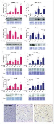 Figure 3. For figure legend, see next page. Src and STAT3 signaling in liver of growing GH-overexpressing mice and normal littermates. A,B: Src phosphorylation at tyrosine 416 in female and male mice. C,D: Src protein abundance in female and male mice. E,F: STAT3 phosphorylation at tyrosine 705 in female and male mice. G,H: STAT3 protein abundance in female and male mice. I: STAT3 liver immunohistochemical staining in male adult mice. Signaling mediators were assessed in liver of GH-transgenic animals (T) and their non-transgenic littermates (N) for 2-week-old (2w), 4-week-old (4w) and 9-week-old (9w) mice. To determine phosphorylation and protein abundance, equal amounts of solubilized liver protein were assessed by immunoblotting. Representative immunoblots (IB) as well as Coomassie blue staining (CBS) of PVDF membranes are shown. Bands were quantified by scanning densitometry. Results were expressed as percentage, referred to the average for 9-week-old transgenic female and male mice. Data are the mean ± SEM of the indicated n number of samples per group, each one representing a different animal. Different letters denote significant difference by age within genotype; small letters correspond to normal mice and capital letters to transgenic animals. Asterisks indicate significant difference between GH-overexpressing animals and their corresponding non-transgenic age controls. Number sign indicates significant difference between sexes. Arrows show the quantified band. For IHC analysis (Panel I), representative photomicrographs of immunohistochemical staining with anti-STAT3 antibody of liver sections from normal and GH-transgenic male adult mice is shown. Positive nuclei are shown with black arrows and negative ones with gray arrows.