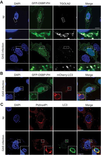 Figure 2. GcAVs contain PtdIns4P. (a) HeLa cells expressing EmGFP-OSBP-PH were infected with GAS for 4 h and immunostained with anti-TGOLN2 antibody. (b) HeLa cells expressing EmGFP-OSBP-PH and mCherry-LC3 were infected with GAS for 4 h. (c) HeLa cells expressing mCherry-LC3 were infected with GAS for 4 h and immunostained with anti-PtdIns4P antibody. Bars: 10 μm. NI, noninfected.