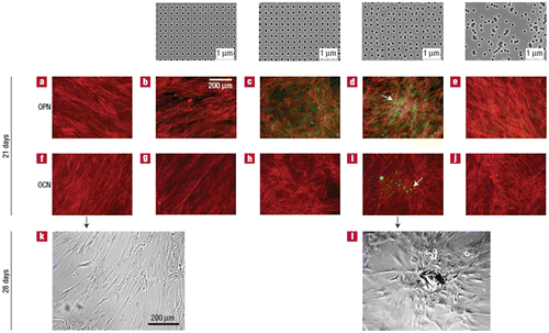 Figure 6. The topmost row shows the images of nanotopographies fabricated by electron beam lithography (EBL). All the pits are 120 nm in diameter, 100 nm deep and have average 300 nm center–center spacing with square, displaced square 20 (±20 nm from true center), displaced square 50 (±50 nm from true center) and random arrangements. (a, f) MSC with fibroblastic appearance and absence of OPN or OCN positive cells on the control, (b, g) no OPN or OCN positive cells on SQ, (c, h) OPN positive cells but no OCN positive cells on DSQ 20, (d, i) OPN and OCN positive cells and nodule formation (arrows) on DSQ 50, (e, j) MSC with osteoblastic morphology and absence of OPN or OCN positive cells on RAND, (k) MSCs with fibroblastic morphology on control after 28 days of culture and (l) mature bone nodules on DSQ 50 after 28 days of culture. Images reproduced with permission from [Citation49].