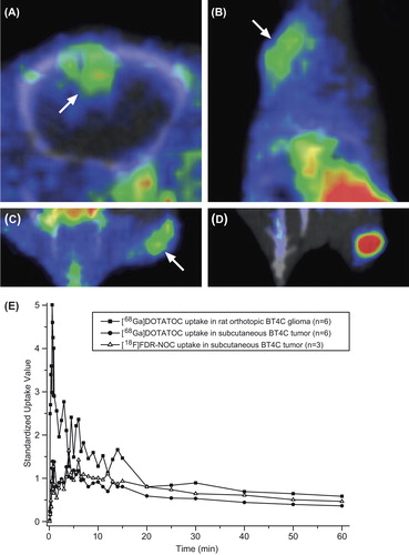 Figure 1. Visualization of BT4C tumors was suboptimal with [68Ga]DOTATOC and [18F]FDR-NOC PET/CT. Representative (A) axial PET/CT image of a BDIX rat brain with an orthotopic BT4C glioma and (B) coronal PET/CT image of a mouse bearing a subcutaneous BT4C tumor in the neck after [68Ga]DOTATOC injection i.v. (C,D) Representative coronal PET/CT images of the same mouse bearing a subcutaneous tumor in the left limb after [18F]FDR-NOC (C) and [18F]FDG (D) injections i.v. The tumor is clearly visualized with [18F]FDG PET/CT. Tumors are indicated with an arrow. PET images represent mean radioactivity concentration at 30–60 min after tracer injection. (E) Time-activity curves of BT4C tumors after injection with [68Ga]DOTATOC or [18F]FDR-NOC. Uptake values are presented as mean SUVmax.