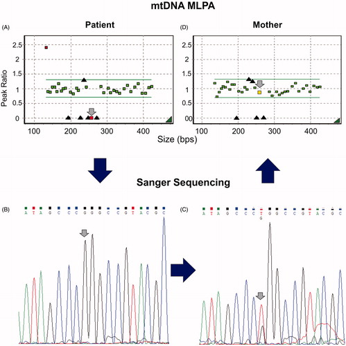 Figure 1. Patient and mother’s molecular characterization. Left column: patient’s studies; right column: mother’s studies. The large arrows shows the genetic diagnostic work-flow that was used in this case. (A and C) Patient and mother’s mtDNA MLPA Ratio chart analyzed by Gene Marker v. 1.75. Boxes in between the horizontal lines correspond to ratios for regions which are present in a normal copy number. Boxes below or above the horizontal lines correspond to ratios for regions which are deleted or duplicated in the analyzed sample. Black triangles: represent ratios for sequence mutated regions (m.3243A > G, m.3460G > A, m.8344A > G, m.11778G > A, and m.14484T > C). Small arrows point to the m.8957–m.9023 probe, found with no amplification signal in the patient and with normal amplification signal in the mother. Amplification signal of probes for two mutation-specific regions is observable. These probes (14484T > C and 8344A > G) can give a low signal in wild-type mtDNA and should have a 10-fold augmentation to consider the presence of a mutation, which is not seen in these cases. In the patient’s assay, the smallest amplified region (first left ratio) seems to be duplicated, this fragment corresponds to a sequence located in the D-loop, where the origin of replication of the heavy mtDNA strand begins, making it a three-strand structure, which can explain this finding. (B and D) Patient and mother’s MT-ATP6 Sanger sequencing: the small arrows point to the m.8993T > G mutation found in homoplasmy in the patient and heteroplasmy in the mother.