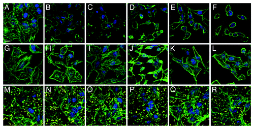 Figure 4. Visualization of anti-adhesion treatment of HeLa cells for representative examples from each group of bacterial isolate. HeLa cells were either left untreated (top row), pre-incubated with BL21-MAM7 (middle row) or pre-treated with bead-immobilized MAM7 (bottom row). Cells were then left uninfected (controls) (A, G and M) or infected with ABC isolate #1 (B, H and N), P. aeruginosa isolate #1 (C, I and O), P. aeruginosa isolate #3 (D, J and P), K. pneumoniae isolate #1 (E, K and Q) or E. coli isolate #5 (F, L and R) for 4 h. Cells were stained for actin (phalloidin-Alexa488, green) and DNA (Hoechst stain). Fluorescent latex beads are shown in yellow. Scalebar, 20 μm.