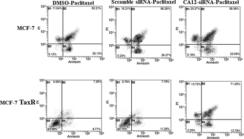 Figure 5. Flow cytometry to detect apoptosis rate. Apoptosis in MCF-7 and MCF-7 TaxR cells after combination siRNA transfection with paclitaxel culture. Compared with the blank control group, *P < 0.05;**P < 0.01. Compared with the negative control group, #P < 0.05; ##P < 0.01