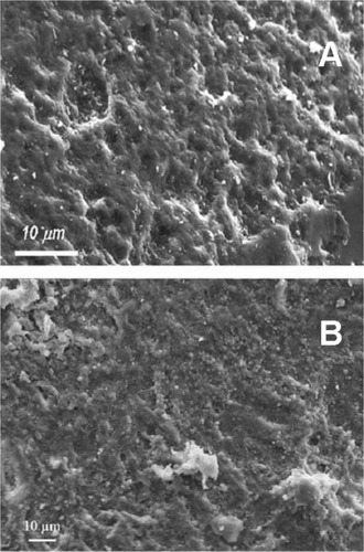 Figure 12 Scanning electron microscopy images of enamel surface after application of A) ortophosphoric acid and B) CHA-contained toothpaste.
