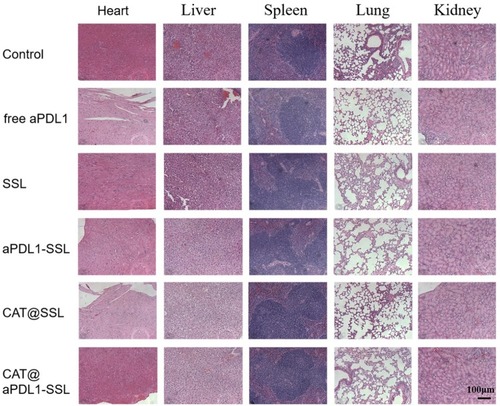 Figure 9 Safety assessment of different formulations in vivo.Notes: The morphology of the main organs, including the heart, liver, spleen, lungs, and kidneys were observed using the H&E staining method after treating mice with PBS, free aPDL1, SSLs, aPDL1-SSLs, CAT@SSLs, or CAT@aPDL1-SSLs (Scale bar: 100 μm).Abbreviations: aPDL1, programmed death ligand 1 monoclonal antibody; CAT, catalase; SSL, sterically stabilized liposome; aPDL1-SSLs, aPDL1 modified immunoliposomes; CAT@aPDL1-SSLs, CAT-loaded immunoliposomes.