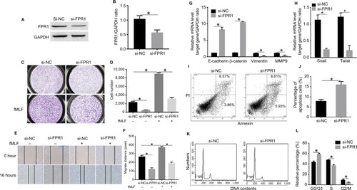 Figure 2 Knockdown of FPR1 represses SiHa cell invasion and migration.Notes: (A, B) Western blot showing FPR1 expression levels in SiHa cells transiently transfected with siRNA against FPR1 (si-FPR1) or scrambled siRNA (si-NC). (C, D) Transwell invasion assays in SiHa cells upon FPR1 knockdown in response to 100 nM fMLF. The magnification is 200×. (E, F) Wound-healing cell migration assay in SiHa cells following FPR1 knockdown in response to 100 nM fMLF. (G) Expression levels of the EMT-related molecules such as E-cadherin, β-catenin, Vimentin and MMP9 were determined by RT-PCR. (H) mRNA levels of the EMT-related transcription factors such as Snail and Twist were determined by RT-PCR. (I, J) FACS analysis of apoptosis in SiHa cells with FPR1 knockdown. (K, L) FACS analysis of the cell cycle in SiHa cells with FPR1 knockdown. Bar chart according to the statistical analysis based on the result of three independent experiments. Data are expressed as mean±SEM. *P<0.05.Abbreviations: EMT, epithelial–mesenchymal transition; fMLF, N-formyl-methionyl-leucyl-phenylalanine; RT-PCR, reverse transcription PCR; SEM, standard error of the mean.