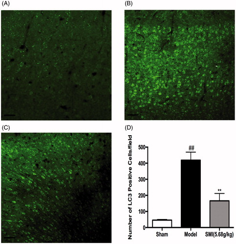 Figure 4. Effects of Shengmai injection (SMI) on the expression of LC3 in brain sections. Representative microphotographs showing immunofluorescence staining for LC3. (A) Mice subjected to the sham operation. (B) Mice subjected to 1h of ischemia and 24h of reperfusion (tMCAO/R). (C) Mice subjected to 1h of ischemia and 24 h of reperfusion (tMCAO/R). SMI (5.68 g/kg, ip) was administered after 1 h of ischemia. Representative brain sections from the ischemic penumbra of the cortex are shown. Scale bars = 50 μm. (D) Quantification of LC3 positive cells in the ischemic penumbra of the cortex (10f fields/brain). n = 3 per group. ##p < 0.01 versus sham-operated mice, **p < 0.01 versus tMCAO/R mice.
