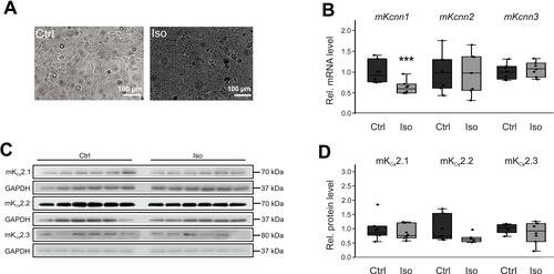 Figure 5 Effects of β-adrenergic stimulation on KCa2 channel expression in HL-1 cells. (A) Representative microphotographs under control conditions (Ctrl) and after incubation with 50 µM isoproterenol for 24 h, respectively (scale bar, 100 µm). (B) Kcnn1 (n = 6), Kcnn2 (n = 6), and Kcnn3 mRNA expression (n = 6) relative to untreated controls (n = 6 each). (C, D) Relative KCa2.1 (n = 6), KCa2.2 (n = 6), and KCa2.3 protein levels (n = 6) compared with controls (n = 6 each). Data are shown as box plots with underlying dots representing original data; ***P < 0.001 versus HL-1 cells not subjected to isoproterenol administration.