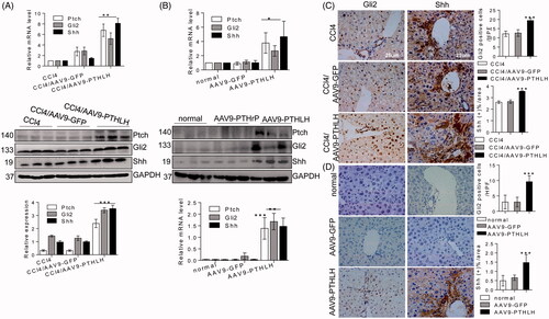 Figure 6. PTHLH treatment resulted in Shh and Gli2 accumulation in fibrotic livers. (A) Shh, Gli2 and Ptch mRNA and protein expression was observed in AAV9-GFP and AAV9-PTHLH mice after CCl4 injection for 5 weeks. (B) Quantitative RT-PCR and Western blot analyses were used to determine the mRNA and protein levels of Ptch, Gli2 and Shh in mice treated with AAV-GFP and AAV9-PTHLH and housed for 6 months. (C) Immunohistochemical staining for Shh and Gli2 and morphometric measurement of the Shh and Gli2 staining scores in AAV9-GFP and AAV9-PTHLH mice after CCl4 injection for 5 weeks. (D) Histomorphometric analysis to determine the percentage of Shh and Gli2 in mice treated with AAV-GFP and AAV9-PTHLH and housed for 6 months. The relative mRNA levels are expressed as fold induction over the level in the vehicle-treated group after normalization to GAPDH, and the relative protein levels were also normalized to the GAPDH level. The data are the mean ± SD fold values over the control. *p < .05, **p < .01, and ***p < .001 versus controls.