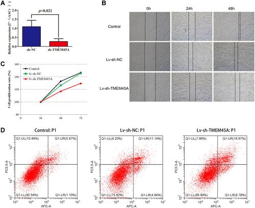 Figure 3 Effect of TMEM45A knockdown on the proliferation, migration, and apoptosis of renal cancer cells. (A) Confirmation of the knockdown efficiency by qPCR demonstrating significantly decreased expression of TMEM45A in the LV-sh-TMEM45A group compared with the LV-sh-NC group. (B) Wound healing assay results showing that TMEM45A knockdown significantly inhibited the migration of ACHN. (C) The results of the MTT assay showing that TMEM45A knockdown significantly inhibited the proliferation of ACHN. (D) TMEM45A knockdown significantly promoted the apoptosis of ACHN.