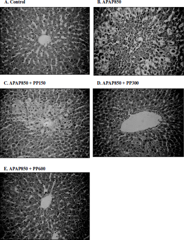 Figure 3.  Histopathological observation of liver sections in APAP alone and APAP + PP treated rats. Liver sections were stained with haematoxylin and eosin (HE stain 176 x). A: Control; B: APAP (850 μg/ml) alone; C: APAP(850 μg/ml) + PP(150 μ g/ml); D: APAP(850 μg/ml) + PP(300 μ g/ml); E: APAP(850 μ g/ml) + PP(600 μ g/ml).