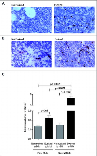 Figure 5. MVD is already increased in the BM of MGUS and SMM patients that subsequently progress to MM. (A and B) Paraffin-embedded sections of BMbs from MGUS (A) and SMM patients (B) were analyzed by immunohistochemistry after staining with anti-factorVIII-RA mAb (40x magnification). (C) Quantification of microvessel area as × 10−2 mm2 in the BM of MGUS and SMM patients at the time of first and second BMb. Data are reported as mean ± SE. Statistical analyses (Student's t test) are reported.