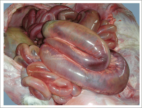 Figure 3. Distended spiral loop of the ascending colon.