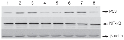 Figure 3 Expressions of P53 and NF-κB protein in Raji cells. Lane 1) control; Lane 2) 0.1 μg/mL ADM; Lane 3) 0.1 μg/mL DNR; Lane 4) 100 μg/mL DEX; Lane 5) 50 μmol/L MNP-Fe3O4; Lane 6) 0.1 μg/mL ADM+ 50 μmol/L MNP-Fe3O4; Lane 7) 0.1μg/mL DNR+ 50 μmol/L MNP-Fe3O4; Lane 8) 100 μg/mL DEX+ 50 μmol/L MNP-Fe3O4.Abbreviations: MNPs(Fe3O4), magnetic nanoparticles of Fe3O4; ADM, adriamycin; DNR, daunorubicin; DEX, dexamethasone.