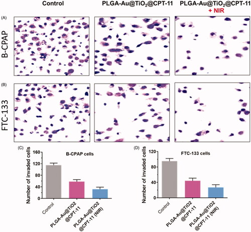 Figure 6. (A, B) The invasion of B-CPAP and FTC-133 thyroid cancer cells was detected via transwell techniques. B-CPAP and FTC-133 cells were treated with PLGA-Au-TiO2@CPT-11 and PLGA-Au-TiO2@CPT-11 + NIR for 24 h. (C, D) The number of invading thyroid cancer cells upon treatment with nanoparticles was remarkably decreased compared with that of the control cells.