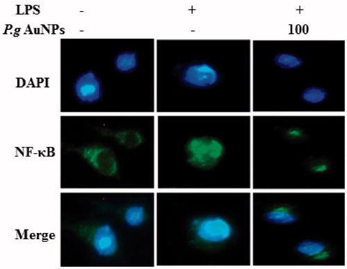 Figure 7. P.g AuNPs inhibited the nuclear translocation of NF-κB induced by LPS in RAW 264.7 cells. Cells were incubated with or without 100 μg/ml ginsenoside P.g AuNPs for 1 h and then stimulated with LPS (1 μg/ml) for 30 min. Cells were stained with rabbit anti-NF-κB p65, followed by Alexa Fluor1488 goat anti-rabbit IgG as a secondary antibody. Nuclei were identified using DAPI. Data are representative of three independent experiments.