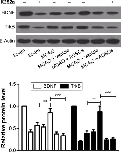 Figure 4 Effects of ADSCs on BDNF and TrkB expression in MCAO rats.