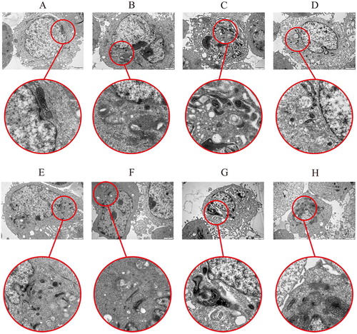 Figure 10 . Damage of β-conglycinin or glycinin on mitochondria. The letters at the top of figures indicate that: A: control group; B: 5 mg mL−1 β-conglycinin group; C: 10 mg mL−1 β-conglycinin group; D: 10 mg mL−1 β-conglycinin + caspase-3 inhibitor group; E: control group; F: 5 mg mL−1 glycinin group; G: 10 mg mL−1 glycinin group; H: 10 mg mL−1 glycinin + caspase-3 inhibitor group.