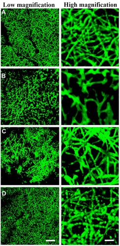 Figure 2 Surface characterization of exosomes immobilized onto PCL/PDA and PCL/PDA + GNSO scaffolds. Representative confocal microscopy images of PCL/PDA (A), PCL/PDA + GSNO (B), PCL/PDA + exosome (C), and PCL/PDA + GSNO + exosome (D) scaffolds. Exosomes were labeled with PKH67 exosome staining solution and incubated with either PCL/PDA or PCL/PDA + GSNO scaffolds. As a control, PCL/PDA or PCL/PDA + GSNO scaffolds were incubated with PKH67 alone. Scale bars for low magnification images represent 50 μm and for high magnification images, 10 μm.