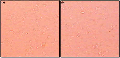 Figure 9. Hemocompatibility study (a) control untreated RBCs, (b) polymeric stent treated with RBCs.