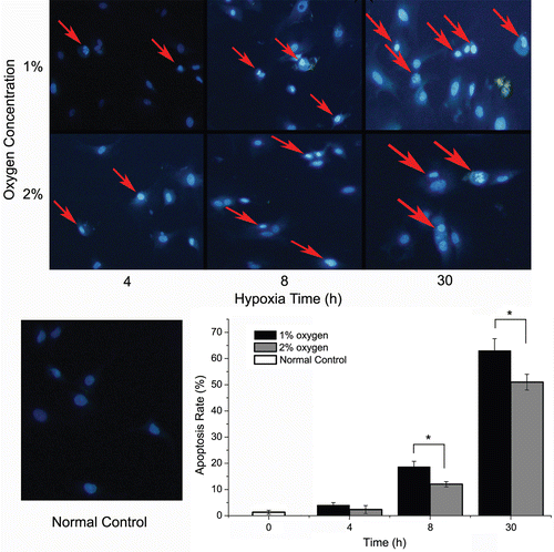 Figure 3.  Hoechst staining of cardiomyocyte in different oxygen concentrations. The Hoechst 33258 staining results in different oxygen concentration (200×). Apoptosis cells show nuclear fragmentation and condensation (red arrows). The apoptotic index was determined by the number of positively stained apoptotic cardiomyocytes/the total number of cardiomyocytes counted × 100%. (*p < 0.05: compared with each other.)