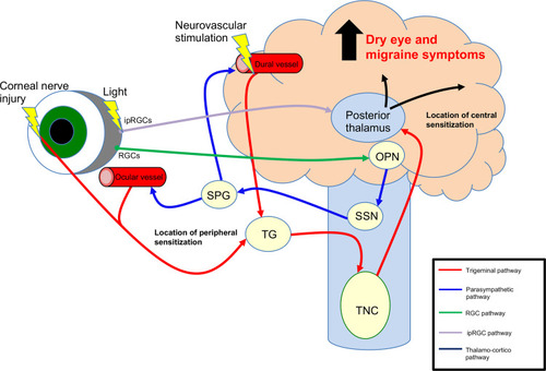 Figure 1 Selected photophobia neural pathways in dry eye and migraine. Light evokes signals from rod and cone cells that are transmitted via amacrine and bipolar cells (not shown) to retinal ganglion cells (RGC), which project to the olivary pretectal nucleus (OPN, green line). Blue line: parasympathetic signals travel from the OPN to the superior salivatory nucleus (SSN), then to the sphenopalatine ganglion (SPG), and ocular and dural vessels to mediate vasodilation. Red line: afferent trigeminal signals from cornea (stimulated by corneal disruptions), ocular vessels, and dural vessels (stimulated by vasodilation) travel to the trigeminal ganglion (TG) then to the trigeminal nucleus caudalis (TNC) and finally the posterior thalamus. Alternatively, light-evoked signals from intrinsically photosensitive RGCs (ipRGC) travel directly to the posterior thalamus (purple line). Black line: signals from the posterior thalamus travel to somatosensory and visual cortices to mediate dry eye and migraine symptoms. Note other pathways of photophobia that involve the hypothalamus and retinal rod and cone cells are not depicted.