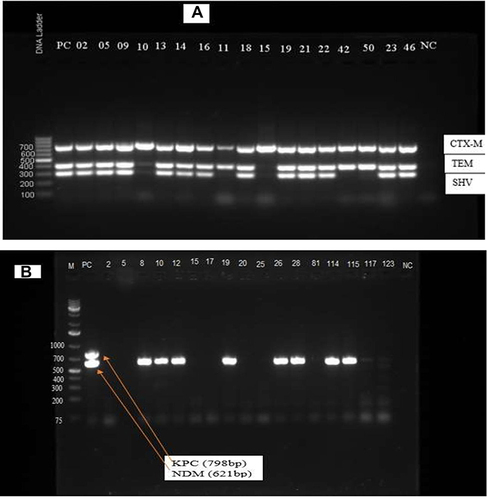 Figure 3 Gel image of the ESBL and carbapenemase genes from Enterobacteriaceae isolates at TASH 2019. (A) blaCTX-M (754bp), blaSHV (403bp) and blaTEM (293bp).