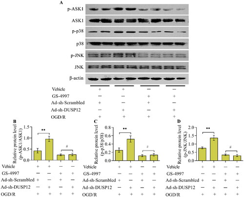 Figure 8. The effect of ASK1 inhibition on DUSP12-mediated JNK/p38 MAPK. Ad-sh-DUSP12-infected neurons were treated with the ASK1 inhibitor GS-4997 and subjected to OGD/R. (A, D) Levels of DUSP12 and phosphorylated ASK1, JNK and p38 were examined by Western blotting and their protein quantification was shown. n = 3. **p < 0.01 and #p > 0.05. Statistical differences were determined using one-way ANOVA followed by Tukey’s post-hoc test.