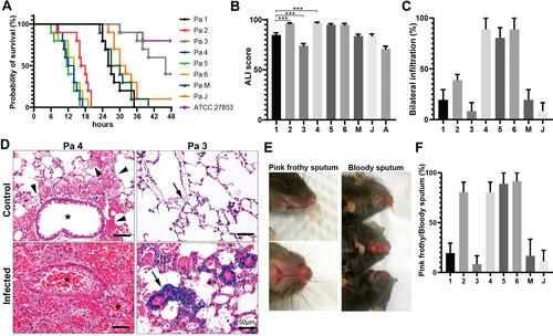 Figure 2 ALI/ARDS induced by different strains of P. aeruginosa in mice (A) Kaplan-Meier survival curves for mice infected with different strains (n=10 in each group). (B) ALI score of mice infected with different strains (n≥4). Mice were euthanized at 12 h post infection. A, ATCC27853; ***P < 0.0005. (C) Rate of occurrence of bilateral infiltration 12h after unilateral inoculation (n=10 in each group). (D) Representative histology findings of the most and least virulent clinical P. aeruginosa strain Pa 4 and Pa 3. Severe DAD and bilateral infiltration occurred in Pa 4 infected lungs. The bronchial lumen (*) was inundated with red blood cells. DAD, hyaline membranes (arrowheads) and neutrophil accumulation even occurred in the uninoculated control lung in Pa 4 infected mice; In Pa 3 infected group, less hemorrhage but more obvious bacterial proliferation and infiltration found in bilateral lungs (arrows). HE stain; (E) pink frothy sputum and bloody sputum observed from the nose and mouth of mice. (F) Rate of occurrence of pink frothy/bloody sputum in different mice groups (n=10 per group).