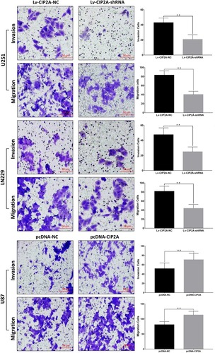 Figure 2 CIP2A influences glioma cellular invasion. Transwell assays showed lower invasion and migration abilities were observed in U251 and LN229 cells transfected with Lv-CIP2A-shRNA compared with Lv-CIP2A-NC (**p < 0.01). pcDNA-CIP2A was used to upregulate CIP2A expression in U87 cells and results showed CIP2A overexpression could promote glioma cellular migration and invasion (**p < 0.01).