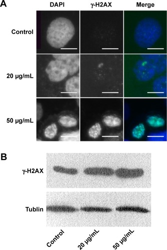 Figure 5 The nucleus in HaCaT cells showed increased γ-H2AX signals after ZnO NPs treatment.Notes: (A) HaCaT cells were grown on glass coverslips, untreated (control) or treated (20 or 50 μg/mL) for 24 hours with ZnO NPs and stained with DAPI (blue). The same cells were also stained with the γ-H2AX antibody, followed by the anti-rabbit secondary antibody (green). Scale bars =10 μm. (B) An increase in γ-H2AX signals was observed after treatment with 20 and 50 μg/mL ZnO NPs compared with the control group. Tublin was used as a protein-loading control.Abbreviations: ZnO NPs, zinc oxide nanoparticles; DAPI, 4,6-diamidino-2-phenylindole.