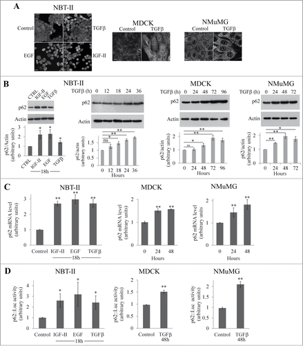 Figure 1. p62 accumulates in NBT-II, MDCK, and NMuMG cells during EMT. (A) p62 was immunostained in NBT-II cells treated or not treated with TGFβ, EGF, or IGF-II for 18 h and in MDCK and NMuMG treated or not with TGFβ for 72 h. Bar, 10 μm. (B) NBT-II cells were treated with IGF-II, EGF, or TGFβ, and levels of p62 were determined after 18 h (right panel). Cells were treated with TGFβ and p62 levels were analyzed as a function of time. Proteins were analyzed by western immunoblotting with anti-p62 and anti-actin antibodies. (C) Levels of p62 mRNA was quantified in NBT-II cells after an 18-h treatment with indicated growth factors; levels were analyzed in MDCK and NMuMG cells as a function of time after treatment with TGFβ. (D) p62 promoter activity was monitored during growth factor-induced EMT in NBT-II, MDCK and NMuMG cells.