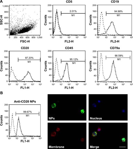 Figure 1 MEC1 cells’ characterization and NPs’ binding.Notes: (A) Cells (5×105) were incubated with PE-conjugated anti-CD5 or anti-CD79a and FITC-conjugated anti-CD19 and anti-CD45 antibodies. The expression of CD20 on the surface of cells was confirmed using an anti-CD20 primary antibody (rituximab) and a FITC-conjugated antihuman secondary antibody. Samples were analyzed by FACSCalibur flow cytometer and data were analyzed by CELLQuest software. (B) FITC-conjugated NPs (green fluorescence) and cells labeled with Fast-DiI (red fluorescence) were incubated for 1 hour. DAPI was used to label nuclei (blue fluorescence). Samples were analyzed by cytometric analysis and with a Leica DM2000 optical microscope. Original magnification 630×.Abbreviations: FITC, fluorescein isothiocyanate; FL1-H, green fluorescence, 530/30 nm bandpass filter; FL2-H, orange fluorescence, 585/42 nm bandpass filter; FSC-H, forward scatter height; M1, Marker 1; NP, nanoparticle; PE, Phycoerythrin; SSC-H, side scatter height.