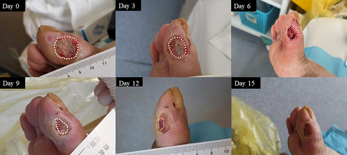 Figure 9 Representative images of the healing process in case 9.