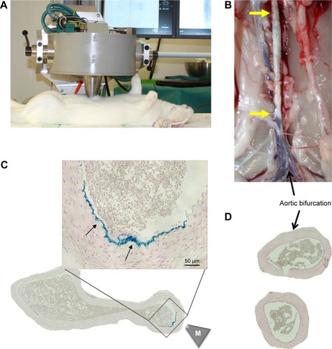 Figure 4 Magnetic targeting setup and efficacy.Notes: SPIONs were magnetically targeted to the injured aortic region directly after the ballooning. (A) Experimental setup and placement of magnetic tip are shown. (B) Following the magnet exposure for 30 minutes, the animals were sacrificed and the excised aorta analyzed histologically. Atherosclerotic plaque is visible as indicated by yellow arrows. (C) The presence of iron in the targeted region was visualized by Prussian blue staining (arrows). Scale bar: 50 µm. (D) No iron accumulation was detected in aortic bifurcation region by histology. The overview images of the artery cross-sections were taken at ×10 objective magnification. M indicates the tip of the magnet.Abbreviations: SPIONs, superparamagnetic iron oxide nanoparticles.