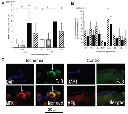 Figure 6 P-SEK1/MEK4 expression co-localized with Fluoro-Jade B-positive cells in the GCL and the time course of the number of p-SEK1/MEK4 positive cells in the GCL. The numbers of p-SEK1/MEK4 positive cells in the GCL in the ischemic retinas were significantly increased compared to those of the control retinas only after 6 hours and 9 hours of reperfusion (A). The number of p-SEK1/MEK4 positive and Fluoro-Jade B positive cells in the GCL in the ischemic retinas was significantly increased compared to that of the control only after 6 hours of reperfusion (A). In ischemic retinas, more than one-half of the cells that were p-SEK1/MEK4-positive were also Fluoro-Jade B-positive in the GCL (B). The sections were obtained from ischemic retinas 6 hours after reperfusion (C) (multi panel). The expression of p-SEK1/MEK4 is co-localized with Fluoro-Jade B-positive cells in the GCL (arrows) (C). (A); White bars showed the number of p-SEK1/MEK4 positive cells in the control retinas and checked bars showed the number of p-SEK1/MEK4 positive and Fluoro-Jade B positive cells in the control retinas. Black bars showed the number of p-SEK1/MEK4 positive cells in the ischemic retinas and stripe bars showed p-SEK1/MEK4 positive and Fluoro-Jade B positive cells in the ischemic retinas.