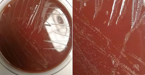 Figure 2 Colony morphology on chocolate agar plate. (A) Slow-growing colonies on chocolate agar plate in a CO2 environment with a concentration of 5% after 48 h. (B) Image of the colonies after magnification.