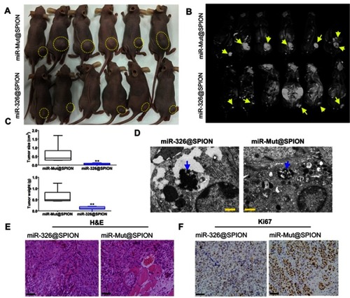 Figure 4 miR-326@SPION significantly inhibits the tumorigenicity of HuECSCs in nude mice. (A) Tumours derived from each group of HuECSCs on the back of nude mice. An arrow indicates the tumour tissue. (B) Results of MRI scans in each group of tumour-bearing mice. A dashed lines indicated the tumour tissue. (C) The tumours derived from miR-326@SPION-HuECSCs in nude mice are significantly smaller in terms of volume and weight compared with tumours derived from miR-mut@SPION-HuECSCs. **P<0.01 vs miR-mut@SPION; t test; n=6. (D) Transmission electron microscopy revealing the presence of high-density electron clouds resulting from the aggregation of circular particles in the xenograft tumours derived from both cell groups. Scale bar =250 nm. (E) The pathological examination results from H&E staining of the tumour sections showing that the tumours derived from both groups of cells display the pathological features of type II EC. Scale bar =30 μm. (F) Immunohistochemical staining results indicating that the percentage of Ki67-positive cells in tumours derived from miR-326@SPION-HuECSCs is significantly lower than that derived from miR-mut@SPION-HuECSCs. Scale bar =30 μm.