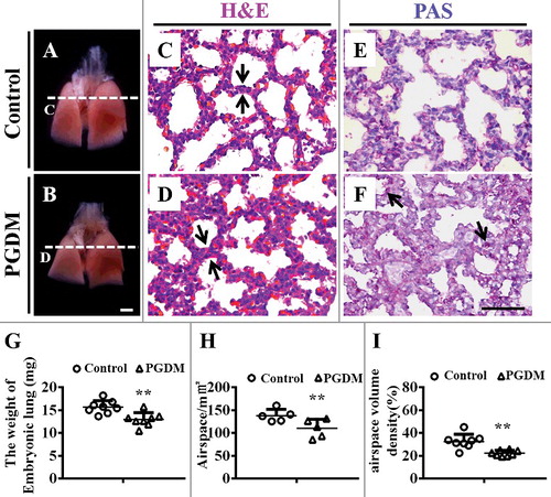 Figure 1. Alteration of the airspace and histology of mouse lungs in the presence of high levels of glucose. A-B: Representative images of mouse lungs from E18.5 in the control (A) and PGDM (B) groups. C-D: The H&E-stained transverse sections of control (C) and PGDM (D) mouse lungs were taken at the levels indicated by the arrows in A-B, respectively. E-F: The PAS-stained transverse sections of control (E) and PGDM (F) mouse lungs were taken at the levels indicated by arrows in A-B, respectively. G: The point and figure chart compares mouse lung weights between the control and PGDM groups. H: The point and figure chart compares the alveolar air spaces between control and PGDM group mice. I: The point and figure chart compares the volume densities of alveolar air spaces (ratio of airspace and total volume) between control and PGDM group mice. Scale bars = 1000 μm in A-B and 50 μm in C-F. *P < 0.05, **P<0.01, ***P<0.001.