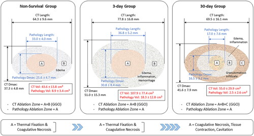 Figure 7. Schematic representation of the MWA site as determined from GGO areas in CT sections and TTC-stained areas in gross pathology slices. Ablation settings were identical for the 3 experimental groups shown (100 W, 10 min). Measurements for the Non-Survival group correspond to Day 0, whereas those for the day-3 and day-30 groups were obtained on Day 3 and Day 30, respectively. Ablation volume was determined with the same ellipsoidal formula for the CT- and Pathology-based sets of measurements. MWA zones were radiologically defined in CT scans as homogeneous GGO areas, whereas gross and histopathological analysis of the MWA site distinguished several concentric areas. A central thermal fixation zone surrounded by an area of coagulative necrosis was observed in formalin-fixed tissue slices in the MWA sites of all groups. These regions, represented by A in the left and central panels, were surrounded by edema in the ablation sites of Non-Survival animals (B on the left panel), and by a larger area of edema, inflammation, and hemorrhage in the ablation sites of 3-Day animals (B on the middle panel). Edema and inflammation were less marked in the MWA sites of 30-Day animals; however, a granulomatous infiltrate adjacent to the area of edema and inflammation (C on the right panel) surrounding the MWA site was observed in all chronic swine. In the swine model used in the present study, areas labeled B in the Non-Survival and 3-Day groups, and B and C in the 30-Day group may have contributed to an overestimation of the GGO areas and thus the ablation zone in CT images of the MWA sites. The model’s schematics shown are scale drawings that kept the aspect ratio of the original CT- and pathology-based measurements (Length and Dmax). Data are expressed as mean ± SD. CT: computed tomography, Dmax, maximum diameter, GGO: ground-glass opacity, Vol: volume.
