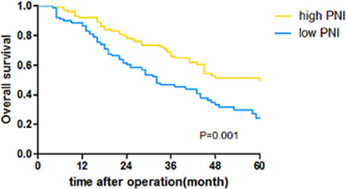 Figure 3 Curves of the overall survival time in patients in the high PNI group and low PNI group with gastric cancer after surgery.