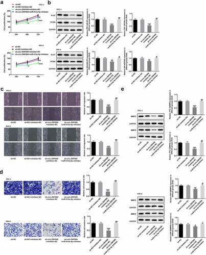 Figure 5. Circ-ZNF609 promotes cell growth and metastasis by down-regulating miR-514a-5p in TPC-1 and IHH-4 cells. (a) Cell proliferation assay employed the experiment of CCK-8. (b) Levels of Ki-67 and PCNA were assessed with the application of Western blot. (c) Cell migration evaluation was undertaken with the help of wound healing. Original magnification: 100 × . (d) Cell invasion experiment was carried out via the way of transwell. Original magnification: 100 × . (e) Levels of MMP2 and MMP9 was examined applying Western blotting. All experimental results are recorded in the form of mean ± SD. *P < 0.05, **P < 0.01, ***P < 0.001 versus sh-NC + inhibitor-NC. #P < 0.05, ##P < 0.01, ###P < 0.001 versus sh-circ-ZNF609 + inhibitor-NC.