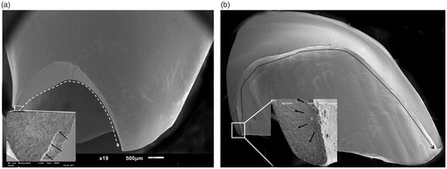 Figure 6. Semilunar fractures. Two typical semilunar fractures of thin crowns. Dotted arrows indicate crack propagation. The areas of fracture origin (white boxes) are seen at higher magnification in separate pictures with black arrows indicating critical crack. (a) A small semilunar fracture where the fracture origin was in a crack on the very margin. Probably from machining damage. (b) The fracture origin in this large semilunar fracture was at the inner wall with no apparent flaw.